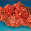Vanadinite